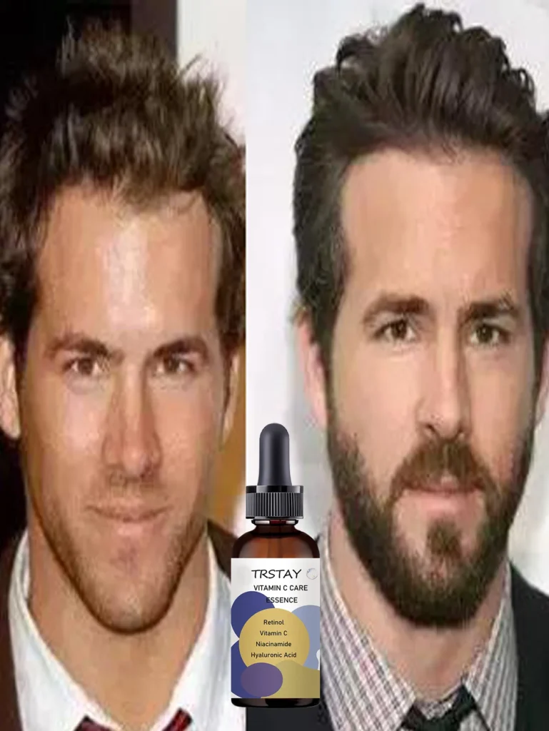 Top Beard Oils for Men to Nourish and Strengthen Facial Hair Naturally