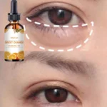 Top Hydrating Eye Oil to Reduce Dark Circles and Soothe Sensitive Skin