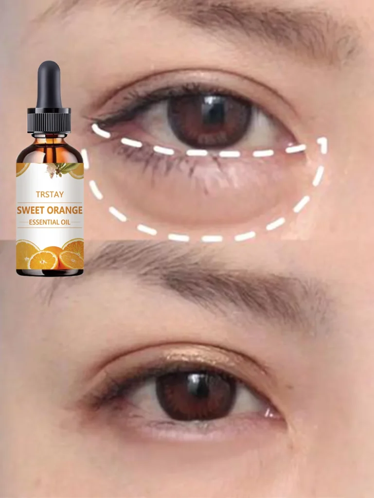 Top Hydrating Eye Oil to Reduce Dark Circles and Soothe Sensitive Skin