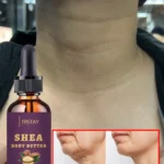 Best Alcohol-Free Neck Care for Smoother Skin and Visible Line Reduction
