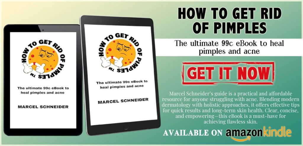 🔬 Professional Advice: Say Goodbye to Pesky Pimples! 🔬   